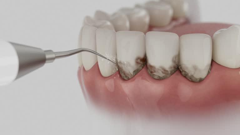 Reliable Dental contractor in Rosemont, PA by Dentist Open Now